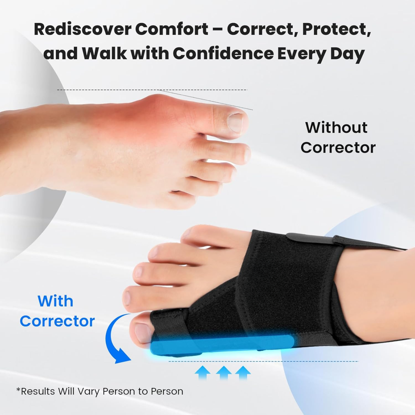 Slumblr® Bunion Corrector for Big Toe Straightener (2pcs)
