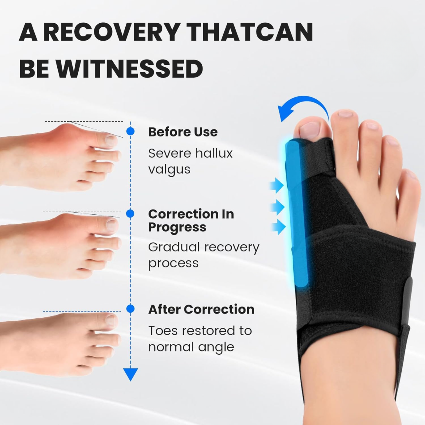 Slumblr® Bunion Corrector for Big Toe Straightener (2pcs)