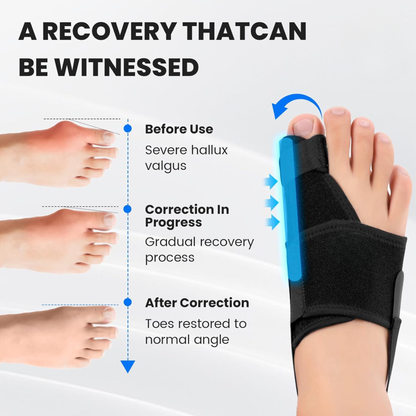 Slumblr® Bunion Corrector for Big Toe Straightener (2pcs)